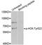 HCK Proto-Oncogene, Src Family Tyrosine Kinase antibody, STJ113502, St John