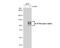 Interleukin 10 Receptor Subunit Alpha antibody, NBP2-16941, Novus Biologicals, Western Blot image 