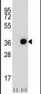 Dehydrogenase/Reductase 3 antibody, PA5-26196, Invitrogen Antibodies, Western Blot image 