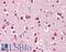 Glutamate Ionotropic Receptor Kainate Type Subunit 1 antibody, LS-B8298, Lifespan Biosciences, Immunohistochemistry paraffin image 