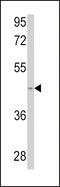 Sphingosine Kinase 1 antibody, 62-748, ProSci, Western Blot image 