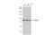 Phosphodiesterase 10A antibody, GTX118886, GeneTex, Western Blot image 