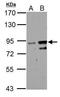 Zinc Finger Protein 598 antibody, PA5-31410, Invitrogen Antibodies, Western Blot image 