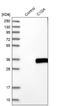 Complement C1q A Chain antibody, NBP1-87492, Novus Biologicals, Western Blot image 