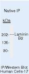 Laminin Subunit Beta 2 antibody, MA5-14646, Invitrogen Antibodies, Immunoprecipitation image 