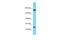 Actin Related Protein 2/3 Complex Subunit 5 antibody, A02096, Boster Biological Technology, Western Blot image 