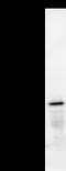 TPX2 Microtubule Nucleation Factor antibody, LS-C342496, Lifespan Biosciences, Immunoprecipitation image 