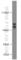 DEAD-Box Helicase 17 antibody, 19910-1-AP, Proteintech Group, Western Blot image 