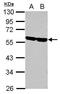 CD2 Molecule antibody, GTX101874, GeneTex, Western Blot image 