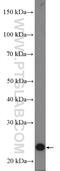 Cysteine Rich Protein 2 antibody, 14801-1-AP, Proteintech Group, Western Blot image 