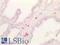 Chymase 1 antibody, LS-B12242, Lifespan Biosciences, Immunohistochemistry paraffin image 