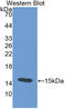 Thyroid Stimulating Hormone Subunit Beta antibody, LS-C314305, Lifespan Biosciences, Western Blot image 