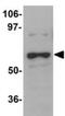 DDB1 And CUL4 Associated Factor 12 antibody, NBP1-77373, Novus Biologicals, Western Blot image 