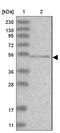 Armadillo Like Helical Domain Containing 1 antibody, NBP1-93486, Novus Biologicals, Western Blot image 