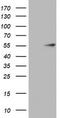 Keratin 20 antibody, LS-C338580, Lifespan Biosciences, Western Blot image 