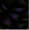 Histone Deacetylase 4 antibody, NBP1-04967, Novus Biologicals, Immunofluorescence image 