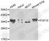 Fibroblast Growth Factor 10 antibody, A1201, ABclonal Technology, Western Blot image 