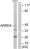 Arrestin Domain Containing 4 antibody, LS-C119394, Lifespan Biosciences, Western Blot image 