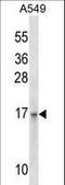 Epithelial Membrane Protein 3 antibody, LS-C159529, Lifespan Biosciences, Western Blot image 