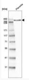 Laminin Subunit Alpha 5 antibody, NBP2-42391, Novus Biologicals, Western Blot image 