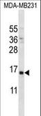Parathyroid Hormone antibody, LS-C162281, Lifespan Biosciences, Western Blot image 