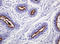 Mucin 1, Cell Surface Associated antibody, LS-C175509, Lifespan Biosciences, Immunohistochemistry frozen image 