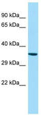 G Protein-Coupled Receptor 160 antibody, TA331207, Origene, Western Blot image 