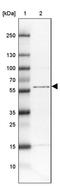 Tetratricopeptide Repeat Domain 31 antibody, PA5-59727, Invitrogen Antibodies, Western Blot image 