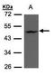 Zinc Finger DHHC-Type Containing 13 antibody, GTX106273, GeneTex, Western Blot image 