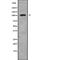 Peroxisomal Biogenesis Factor 6 antibody, abx217720, Abbexa, Western Blot image 