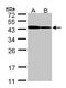 ADP-Ribosyltransferase 5 antibody, PA5-28544, Invitrogen Antibodies, Western Blot image 