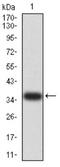 P21 (RAC1) Activated Kinase 3 antibody, NBP2-61766, Novus Biologicals, Western Blot image 
