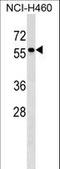 Tyrosinase Related Protein 1 antibody, LS-C157304, Lifespan Biosciences, Western Blot image 