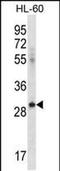 Inducible T Cell Costimulator Ligand antibody, PA5-48719, Invitrogen Antibodies, Western Blot image 