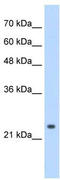 Cleavage And Polyadenylation Specific Factor 4 antibody, TA345981, Origene, Western Blot image 