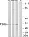 TNF Alpha Induced Protein 6 antibody, A30469, Boster Biological Technology, Western Blot image 