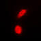 Death Domain Associated Protein antibody, GTX56298, GeneTex, Immunofluorescence image 