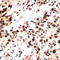 RAD51 Recombinase antibody, LS-C368495, Lifespan Biosciences, Immunohistochemistry frozen image 