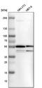 Serine Hydroxymethyltransferase 2 antibody, PA5-54230, Invitrogen Antibodies, Western Blot image 