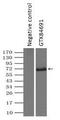 Checkpoint Kinase 2 antibody, GTX84691, GeneTex, Immunoprecipitation image 