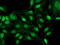 Alcohol Dehydrogenase 1B (Class I), Beta Polypeptide antibody, M01316, Boster Biological Technology, Immunofluorescence image 
