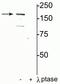 Glutamate Ionotropic Receptor NMDA Type Subunit 2A antibody, P01949, Boster Biological Technology, Western Blot image 