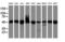 Ubiquinol-Cytochrome C Reductase Core Protein 1 antibody, M06974, Boster Biological Technology, Western Blot image 