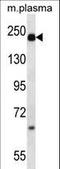 Alpha-2-macroglobulin antibody, LS-C155821, Lifespan Biosciences, Western Blot image 