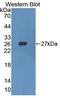 Sterol Regulatory Element Binding Transcription Factor 1 antibody, LS-C702970, Lifespan Biosciences, Western Blot image 