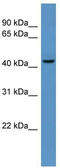 Beta-1,4-Galactosyltransferase 6 antibody, TA339432, Origene, Western Blot image 