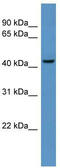 Beta-1,4-Galactosyltransferase 6 antibody, TA339432, Origene, Western Blot image 