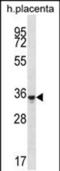 Olfactory Receptor Family 6 Subfamily K Member 6 antibody, PA5-48544, Invitrogen Antibodies, Western Blot image 