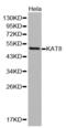 Lysine Acetyltransferase 8 antibody, abx001819, Abbexa, Western Blot image 
