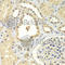 Zinc Finger Protein 346 antibody, A7507, ABclonal Technology, Immunohistochemistry paraffin image 